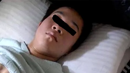 Un tânăr din China a trăit 24 de ani cu inima în abdomen