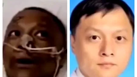 UIMITOR. Doi medici infectați cu COVID-19 s-au trezit cu pielea închisă la culoare. Cum a fost posibil | GALERIE FOTO