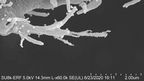 SINISTRU. Imagini cu celulele-zombi atacate de coronavirus și transformate în tentacule ucigașe
