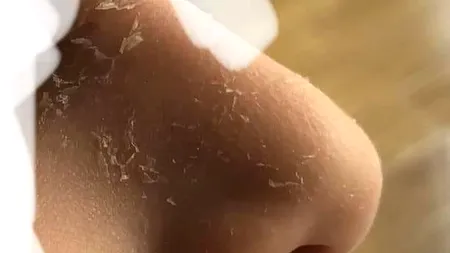 Șase elevi din Ilfov au ajuns la spital, după ce au fost expuși la raze ultraviolete în școală. Chiar învățătoarea lor pornise lampa în clasă