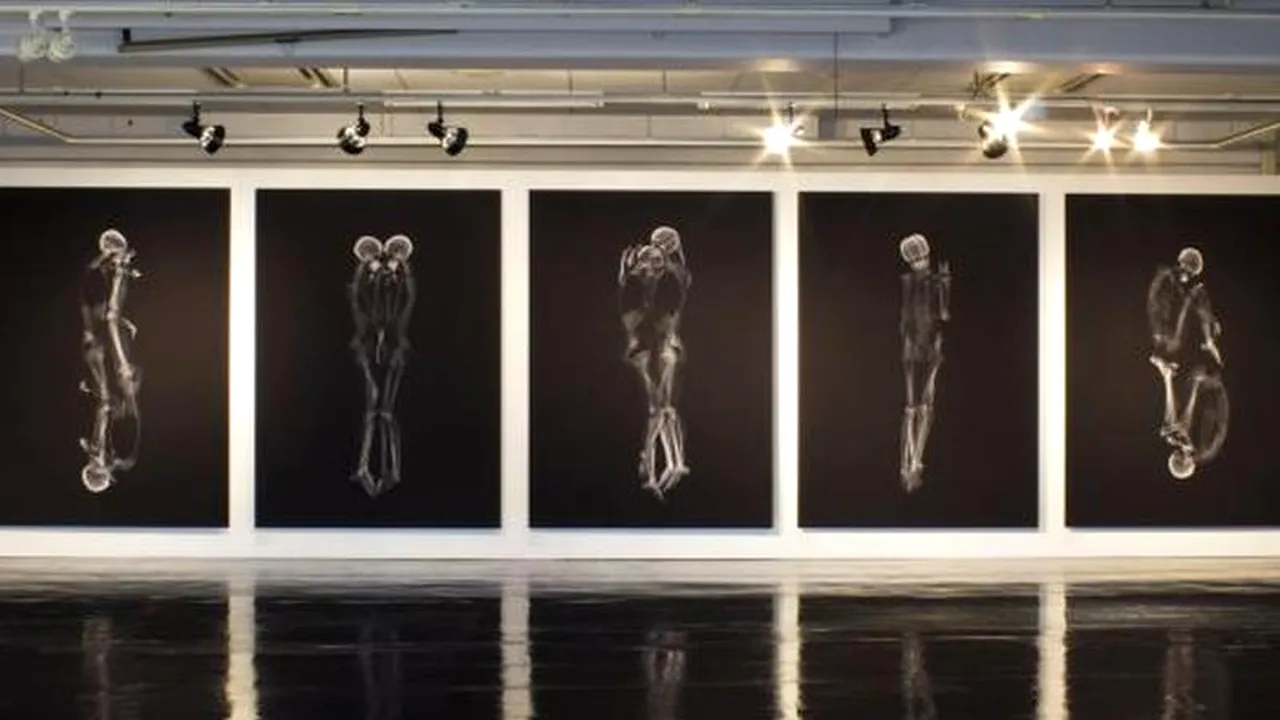 Cupluri îmbrățișate sau cum arată osatura unei relații văzută „la raze X