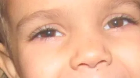 VIDEO. Ce a pățit o fetiță din SUA după o vizită la dentist