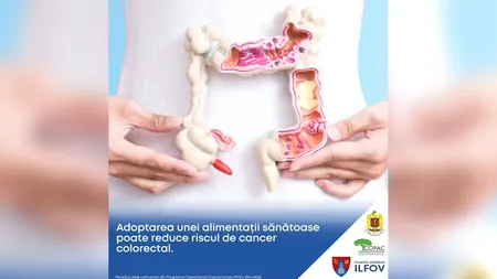 Locuitorii eligibili din Ilfov pot face screening colorectal gratuit. „Depistarea precoce crește șansele de tratament și vindecare”