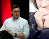 Ai mâinile reci? Ce ascunde acest simptom, potrivit doctorului Mihail Pautov