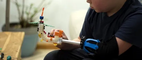 Povestea impresionantă a băiatului de 9 ani care și-a construit  singur o proteză din piese Lego