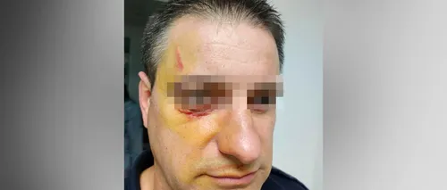 Polițist atacat de un refugiat într-un centru de cazare pentru imigranți. Ofițerul a avut nevoie de intervenția medicilor