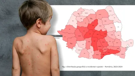 Brașov, în topul rujeolei. Capitala este abia pe locul doi