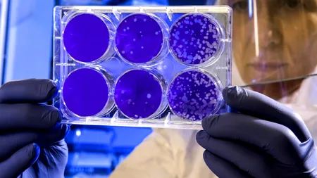 Studiu Covid-19. Persoanele infectate au imunitate la noul coronavirus cel puțin 8 luni!