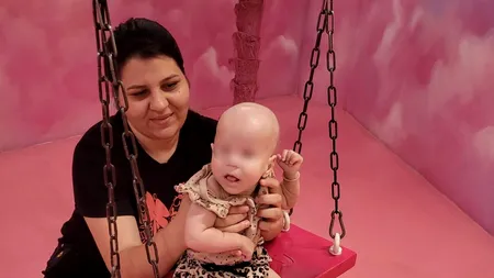 Drama singurei fetițe din România născută fără globi oculari. “Medicii pediatri din țară fug de noi”