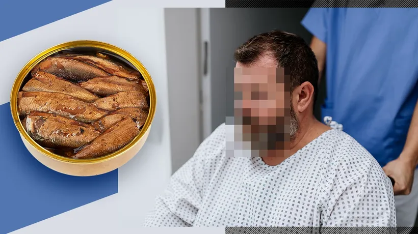 Botulism în Prahova. Pacientul a mâncat conserve de pește expirate. „Antidotul” a fost adus din Moldova. În România nu există ANTIOXINĂ BOTULINICĂ!