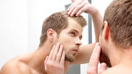 Cât de sigur este și cât costă un implant de păr