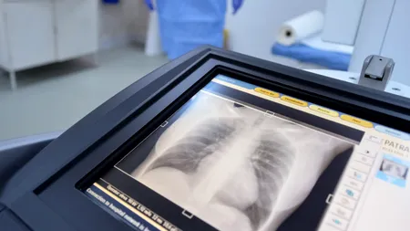 Descoperirea uluitoare făcută de un medic român în corpul unei femei. A trăit așa 30 de ani: „Am înghețat”