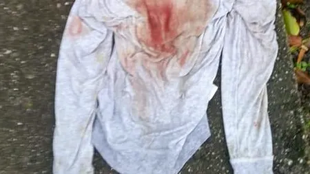 Doi oameni din Teleorman au ajuns la spital, după ce au fost bătuți de hoții care au intrat în locuința lor prin acoperiș