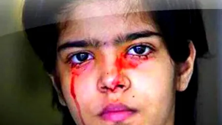 Cea mai rară și misterioasă boală din lume