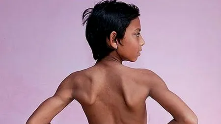 Ce a crescut pe spatele acestui băiat: toți locuitorii din sat îl venerează pentru asta