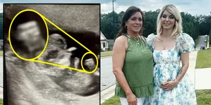 Această femeie gravidă a rămas mască după ce a făcut o ecografie. Detaliul BULVERSANT observat în această imagine