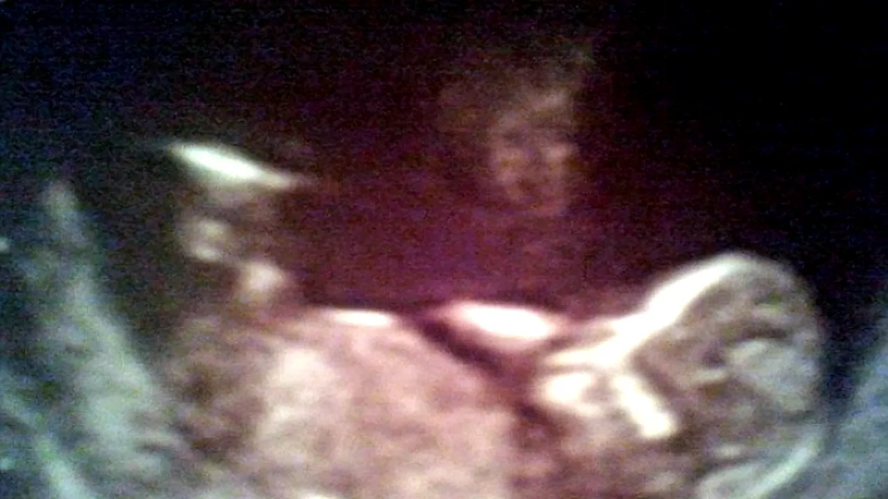 FOTO. Ce au văzut doi părinți în ecografia viitorului lor copil