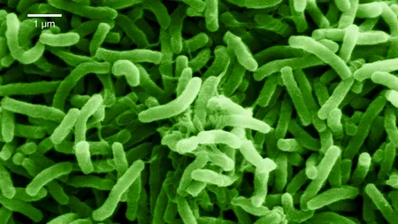 Alertă medicală! Focar de holeră în Nigeria. Zeci de oameni au murit