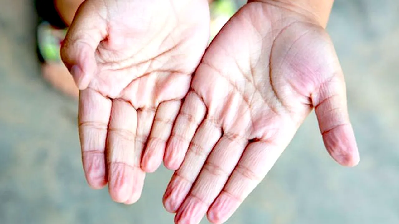 Motivul pentru care se încrețesc degetele dacă stăm prea mult în apă