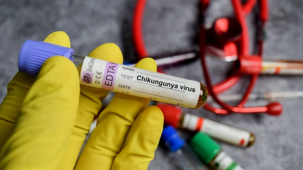 Alertă sanitară în New York. Prezența unui nou VIRUS a fost confirmată de autorități. Cum se transmite și care sunt simptomele
