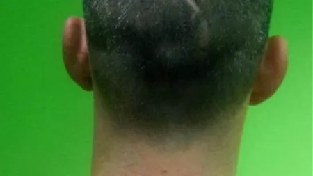 Metodă inedită găsită de acest bărbat pentru a scăpa de un tatuaj nedorit