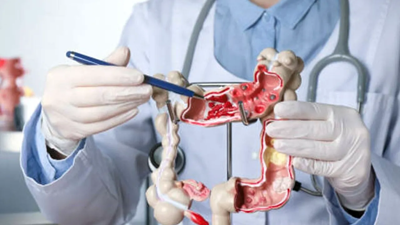 Programul de prevenție și depistare precoce, diagnostic și tratament  al leziunilor precanceroase colorectale la nivelul județului Ilfov continuă (P)