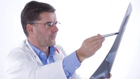 Cele mai bizare lucruri pe care medicii le-au scos din nasurile oamenilor