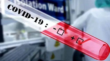 COVID-19. Cum funcționează testul pentru coronavirus care îți dă rezultatul în 15 minute și poate fi făcut acasă