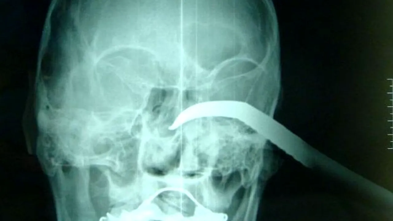 Lumea medicală, uimită de această imagine