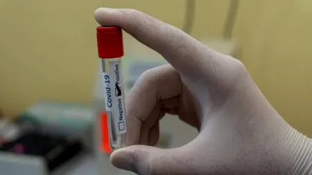 Femeie sănătoasă, reinfectată cu coronavirus