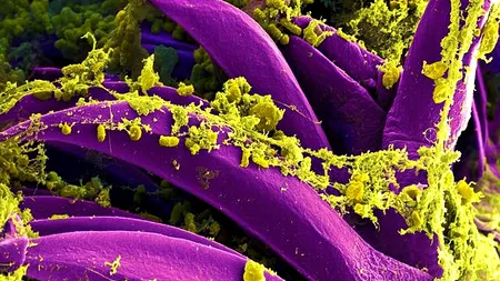 Ucigașii viitorului. Cum vor ajunge infecțiile prima cauză a mortalității