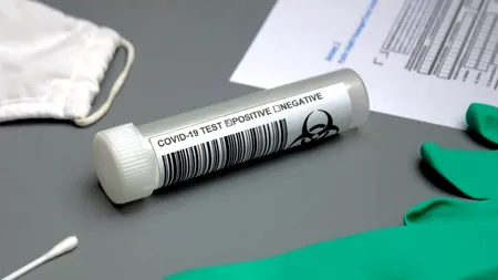 Cum justifică autoritățile că avem aproape o mie de cazuri noi COVID-19 şi la 6 mii de teste, dar şi la 22 de mii?! (EXCLUSIV)