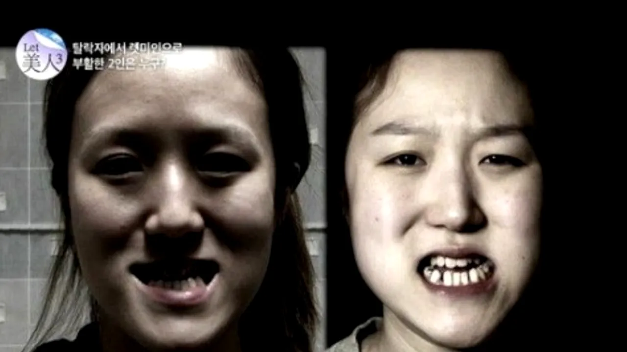 Cum arată aceste gemene după câteva operații estetice