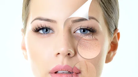 Cum putem scăpa de riduri