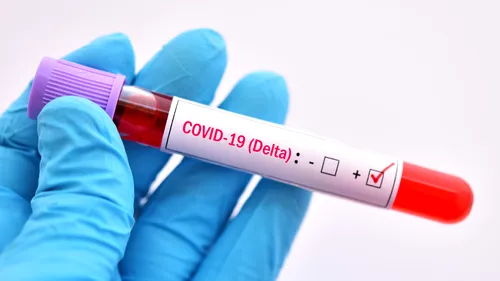 O femeie din Constanță, vaccinată anti-COVID, a murit după ce s-a infectat cu tulpina Delta