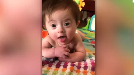 O fetiță care suferă de sindromul Down îi zâmbește mamei sale, într-un clip emoționant: „Oh, ești cea mai drăguță din lume