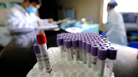 FOCAR. OMS a făcut anunțul despre CIUMA BUBONICĂ, noul pericol din China