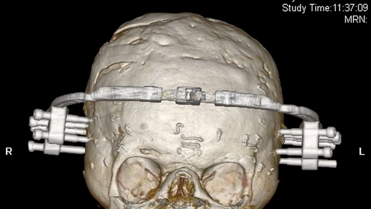 Când s-a născut medicii nu i-au dat nicio șansă la viață. Acum a fost declarat 
