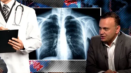 VIDEO | Medicul Adrian Marinescu explică ce trebuie să faci dacă te confrunți cu pneumonia: „Este o complicație extrem de frecventă”