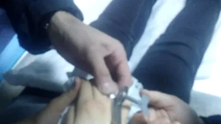 FOTO | Misiune inedită pentru pompierii din Botoșani. Angajații ISU au fost solicitați de medicii de la spital să-i ajute să scoată un inel de pe degetul unui copil de 13 ani