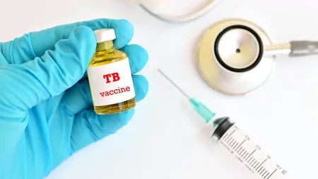 Ministerul Sănătății demarează un program de depistare activă a tuberculozei, în 11 județe. Care sunt zonele vizate de această acțiune