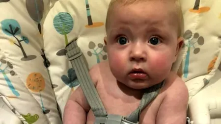 O mămică al cărei bebeluș a fost tratat în spital de COVID-19 prezintă simptomele la care părinții ar trebui să fie atenți - FOTO