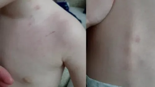 Un copil de doi ani a fost bătut de asistenta de la creșă, pentru că nu a stat pe oliță. Mama băiețelului: „Probabil a fost prins cu forța