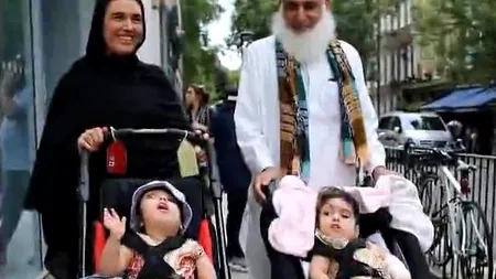 Operație miraculoasă: Două fetițe, gemene, care s-au născut cu scalpurile lipite, au fost salvate într-o operație incredilă ce a durat 50 de ore - VIDEO