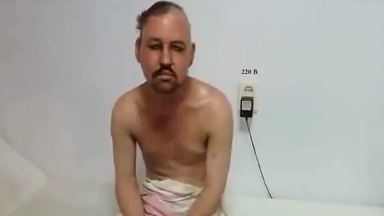 Căzuse într-o groapă plină cu o substanță toxică, dar a supraviețuit. Ce metodă neobișnuită au folosit medicii pentgru a-l salva - FOTO 