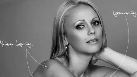 Mărturii emoționante despre frumusețea și imperfecțiunea corpului omenesc. Fotografii pe care nu le vei vedea niciodată în revistele glossy