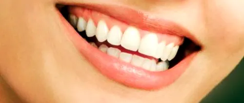 Cum să-ți albești dinții în trei minute? VIDEO