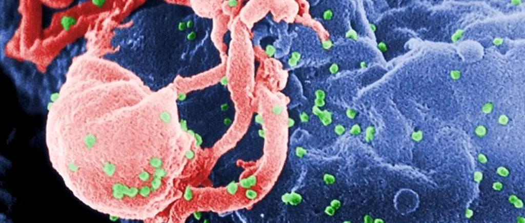 STUDIU. Celulele stem ar putea anihila virusul HIV