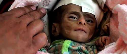 IMAGINEA DISPERĂRII: Yemen, țara unde milioane de oameni mor de foame, iar politicienii cer VOTURI CONTRA HRANĂ
