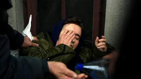 #roMânia SINDROMUL ITALIA. Boala 